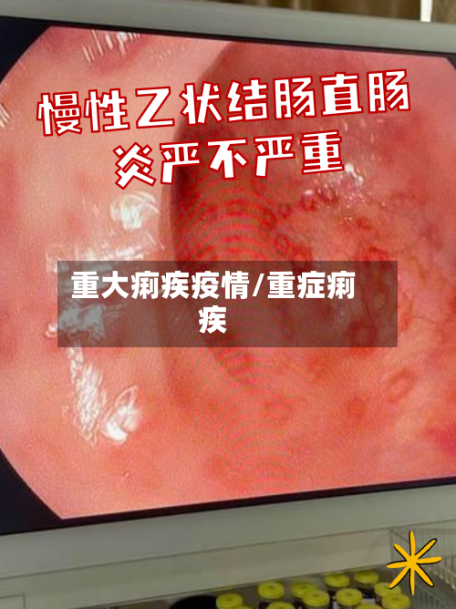 重大痢疾疫情/重症痢疾-第2张图片