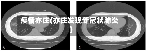 疫情亦庄(亦庄发现新冠状肺炎)